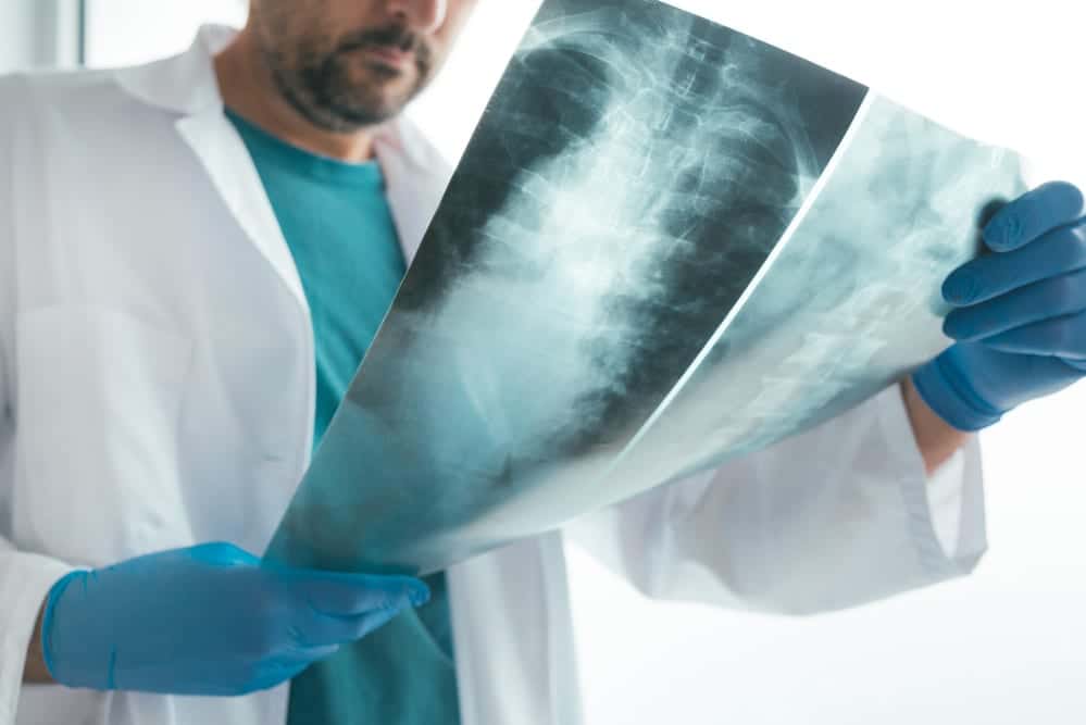 8 First Signs Of Lung Cancer : What Experts Say To Look For - 1