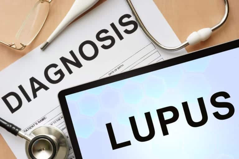 What Are The Early Signs Of Lupus? - 4