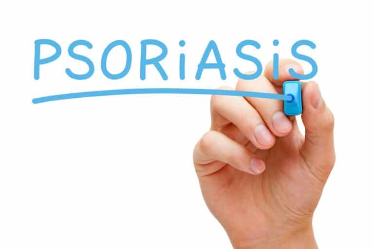 What Is Plaque Psoriasis? Learn The Warning Signs &Amp; How It'S Treated - 1